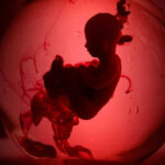 Second Lady PREGNANT — Fourth Child On the Way Silhouette of fetus in red-lit environment.